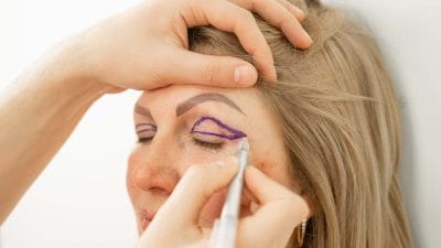 Goz Kapagi Ameliyati Fiyatlari Augenlidoperation Preise