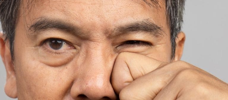 Göz Seğirmesi Nedir? Göz Seğirmesi Nasıl Geçer?