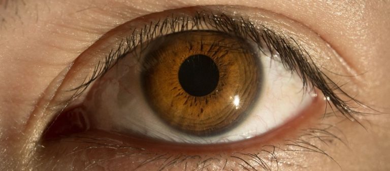 Optik Nevrit: Nedenleri, Belirtileri ve Tedavisi