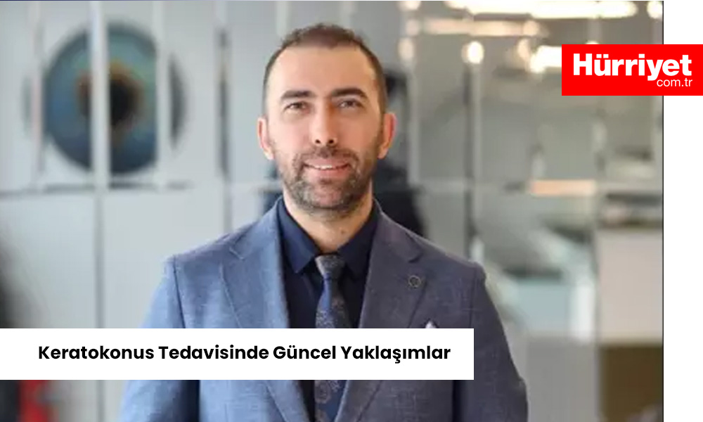 Keratokonus Tedavisinde Guncel Yaklasimlar Yazılı Medya