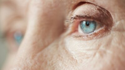 Diyabetik Retinopati Nedir Belirtileri Nedenleri ve Tedavisi Diyabetik Retinopati Nedir ? Belirtileri, Nedenleri ve Tedavisi