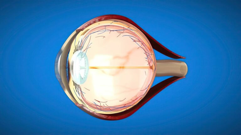 Retina Dekolmanı Nedir? Belirtileri, Nedenleri ve Tedavisi