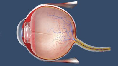 Vitreus Nedir Vitreus Bozuklugu Tedavisi Nasil Yapilmaktadir Vitreus Nedir? Vitreus Bozukluğu Tedavisi Nasıl Yapılmaktadır?