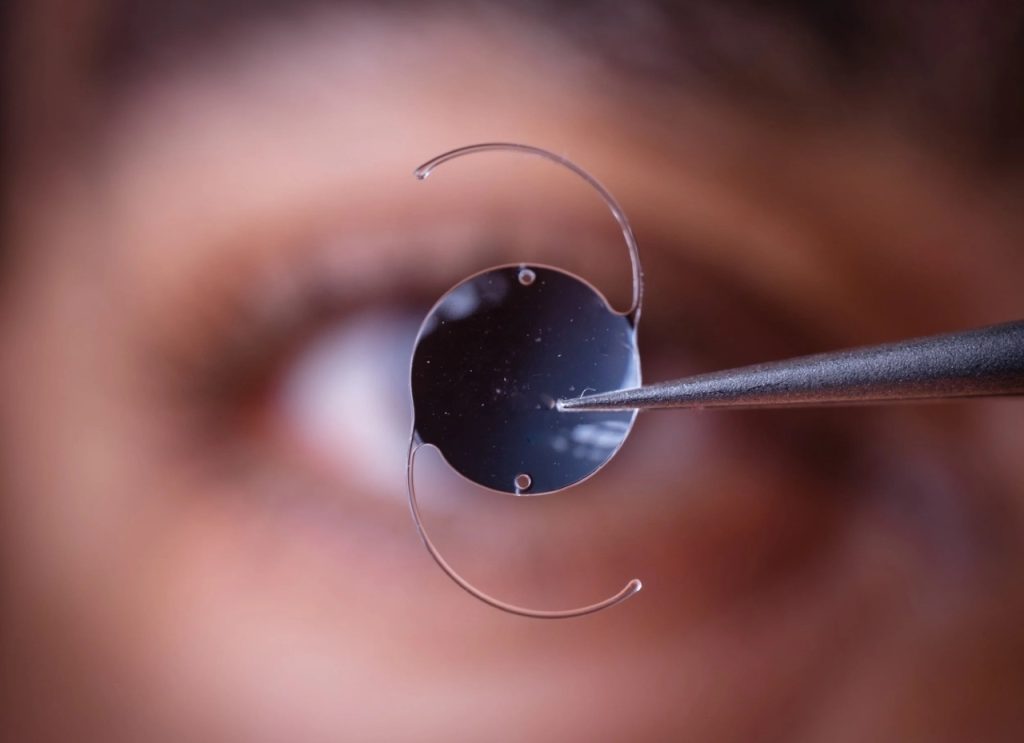 Accommodating Lens Surgery